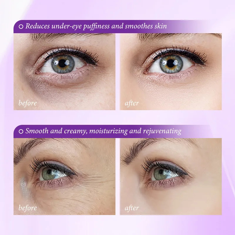 Instant Eye Bag Removal Cream  - Skincare D'Alba 评论和价格