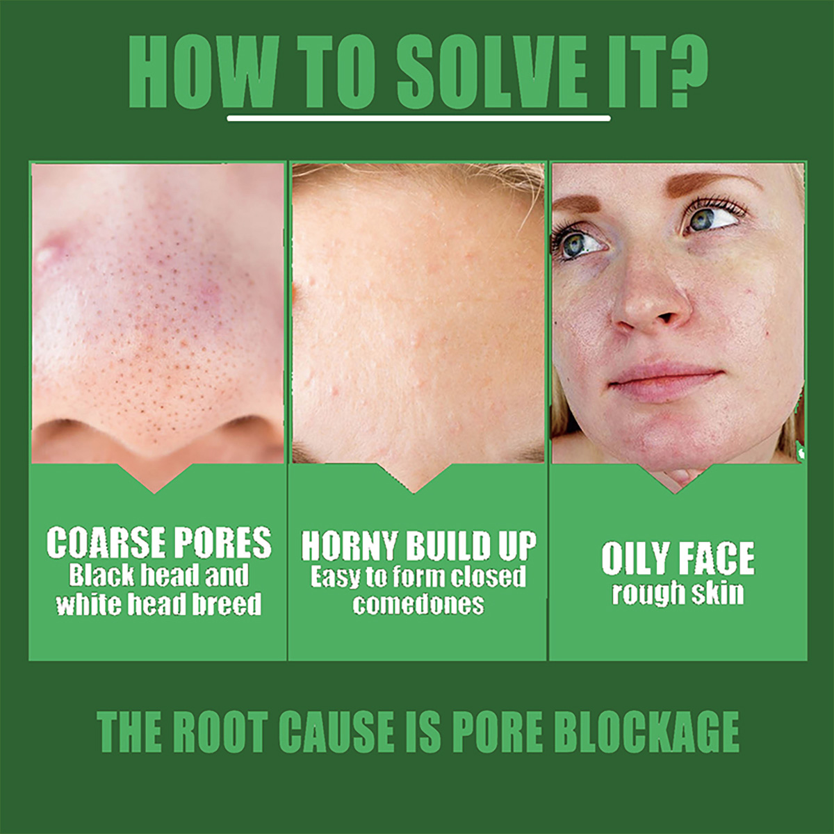 Shrink pores Remove acne marks - Licorice Root Extract 评论和价格