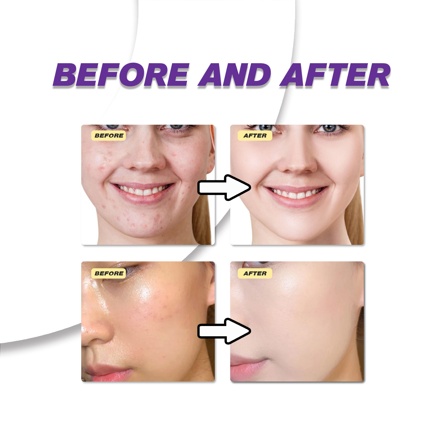 Mild Azelaic Acid Cream Improv - Skincare Skintific 评论和价格