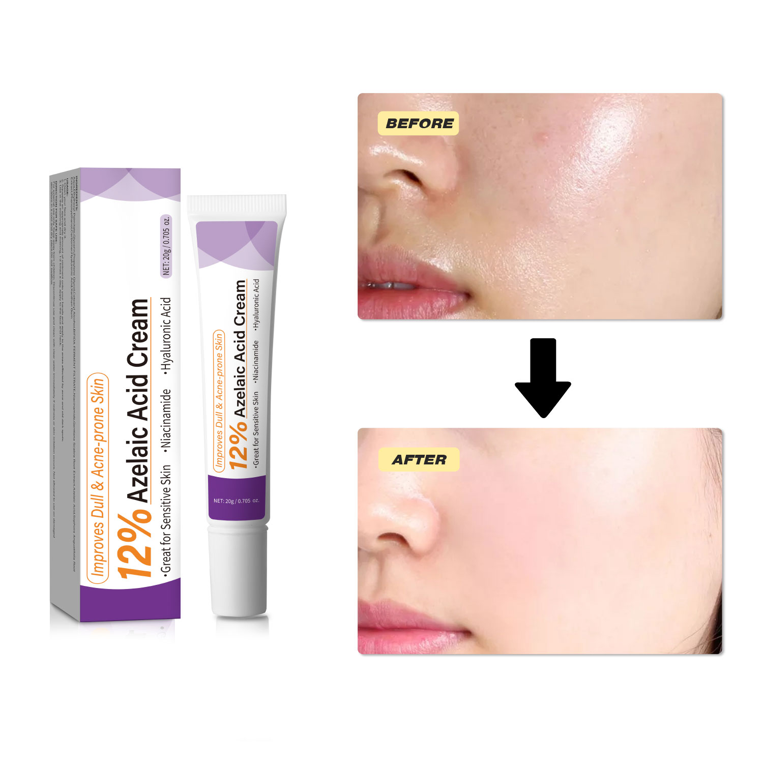 Mild Azelaic Acid Cream Improv - Skincare Skintific 评论和价格